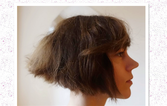 耳软骨隆鼻有什么危害 用耳软骨垫鼻子的6大害处