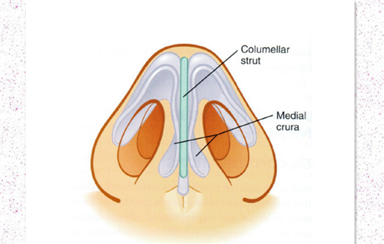膨体隆鼻鼻头多久恢复 1个月消肿3-6个月软化至正常