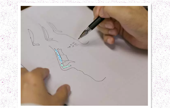 进口膨体和国产膨体的区别 进口国产哪种更好你要知道