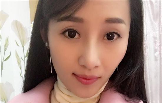 膨体隆鼻日记 带你了解膨体隆鼻术后恢复历程