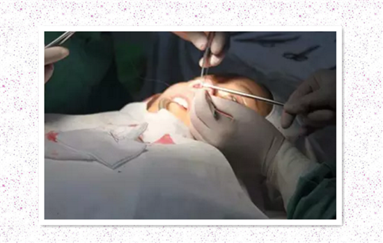 膨体隆鼻材料介绍 隆鼻膨体有哪些优缺点