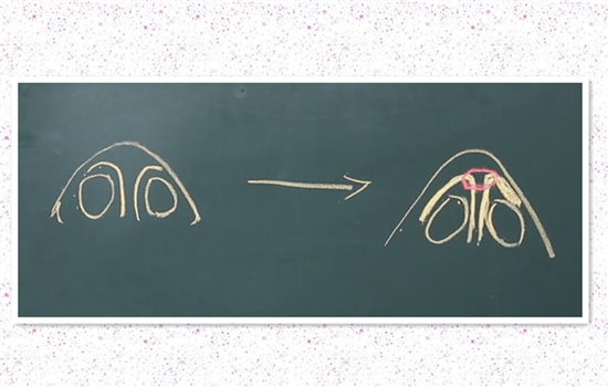 鼻翼缩小后会不会增生 极少数瘢痕体质者会术后有增生