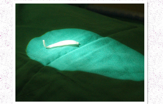 鼻子修复是怎么做的 多图解析隆鼻取出全部过程