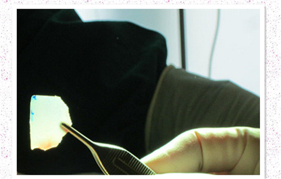 鼻子修复是怎么做的 多图解析隆鼻取出全部过程