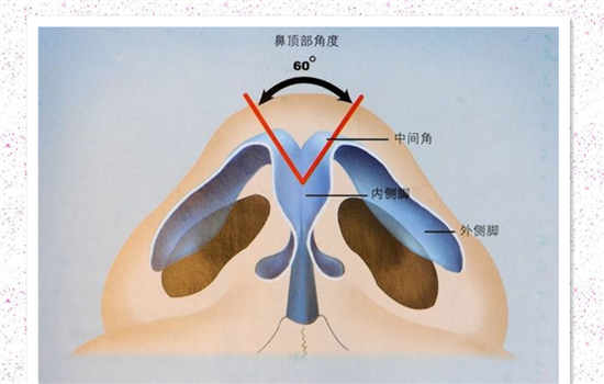 鼻头缩小的切口位置 缩鼻头手术主要有两种切口