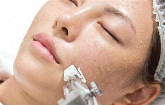 无针水光为什么会过敏 告诉你你过敏原因和解决方法