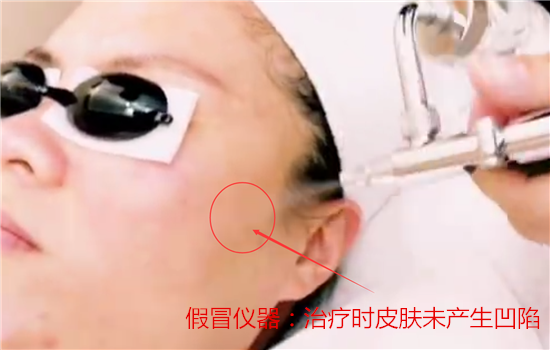 无针水光用什么产品 这三种玻尿酸产品最具代表性