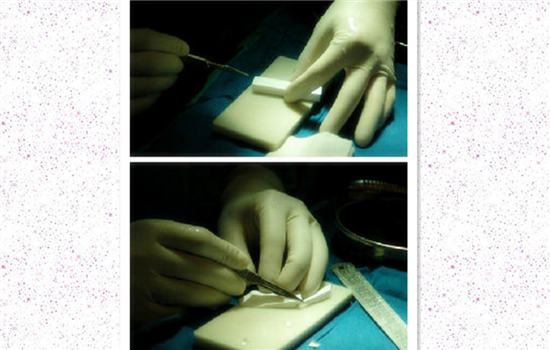 达拉斯隆鼻包括什么 所包项目根据鼻部条件而定