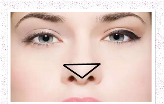 达拉斯鼻综合保持几年 达拉斯鼻怎样能安全维持效果