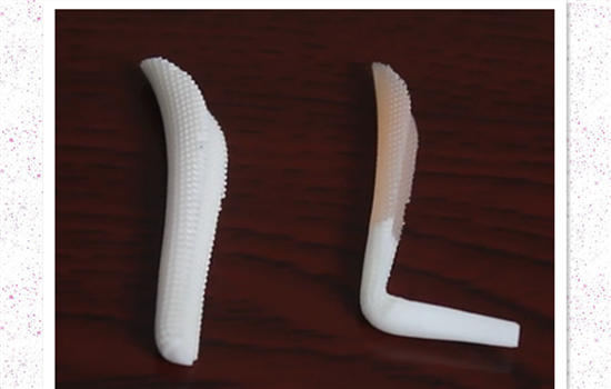 L型假体和柳叶形假体哪个好 一时选错将害自己一生