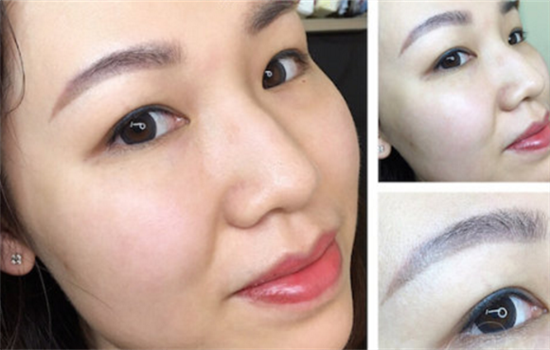 什么叫轻氧眉 创伤更小的氧气眉你真的了解吗
