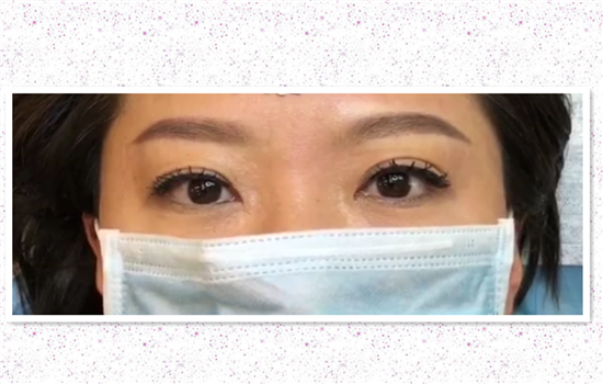 什么叫轻氧眉 创伤更小的氧气眉你真的了解吗