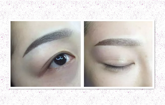 轻氧眉会结痂吗 千万别被无良商家欺骗