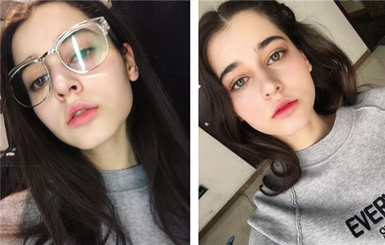 切眉怎么切 深度揭秘眉形矫正的外科手术