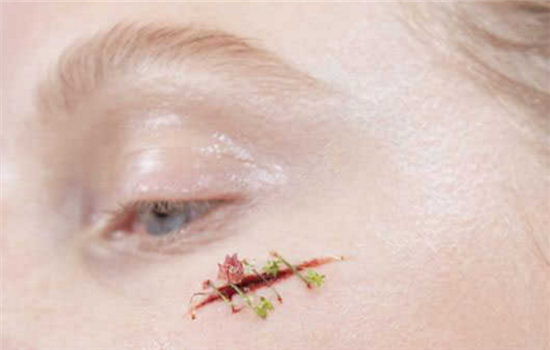 切眉手术疤痕怎么办 强烈推荐解决疤痕的4种好办法