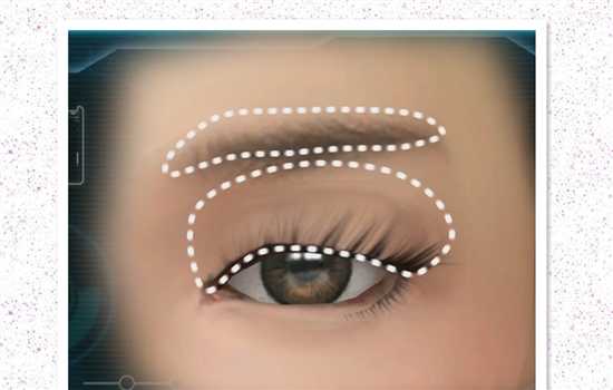 切眉整容手术过程图片 胆小者千万别看