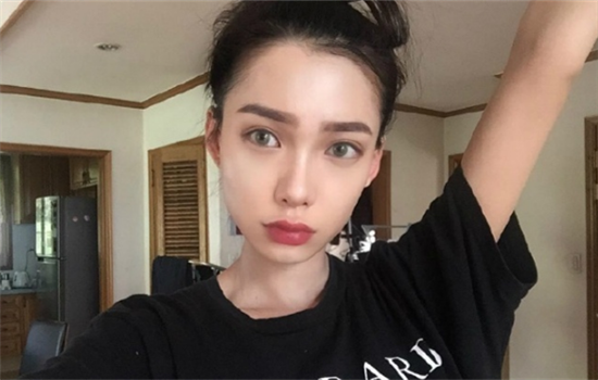 切眉的危害 看完你还敢做切眉手术吗