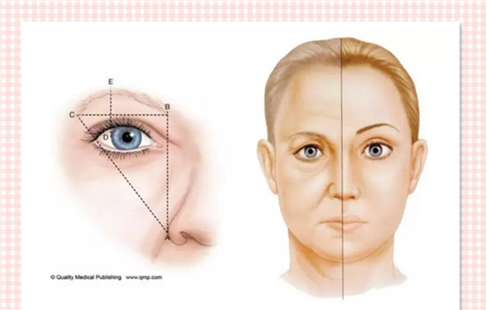 切眉的最佳年龄 你是在切眉的黄金年龄吗