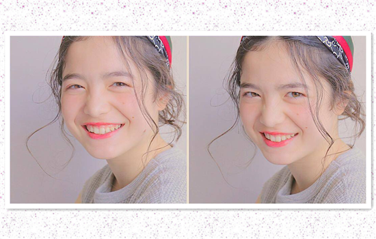 提眉后为何眼睛不自然 不敢相信竟是这三个原因导致