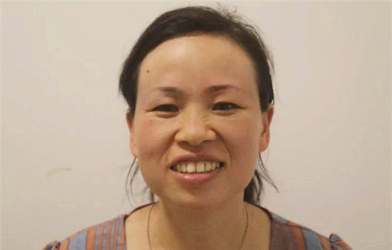 切眉1一7天的图片恢复过程 看后惊呆