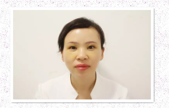 切眉1一7天的图片恢复过程 看后惊呆