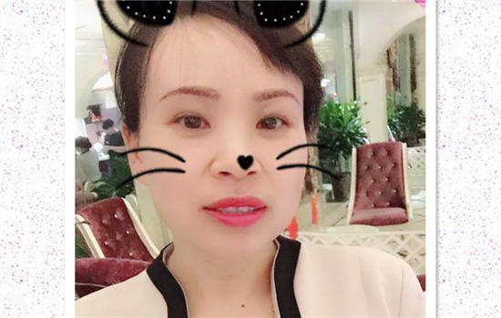 切眉1一7天的图片恢复过程 看后惊呆