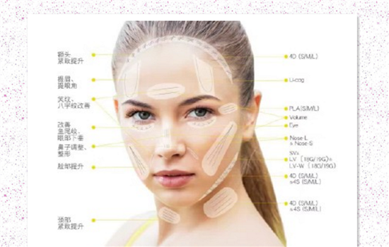 大v线和小v线的区别 你一定要收藏的线雕干货