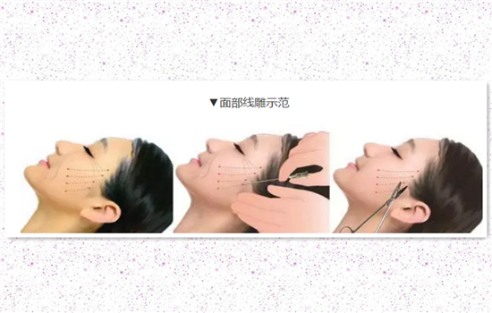 大v线和小v线的区别 你一定要收藏的线雕干货