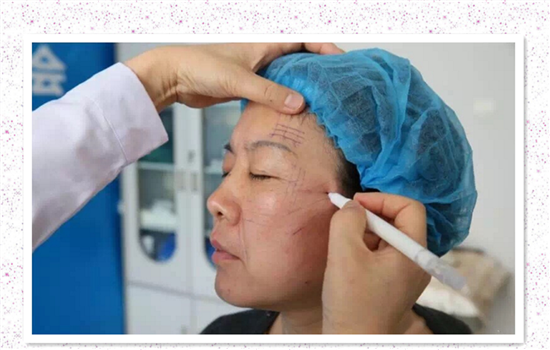 大v线和小v线的区别 你一定要收藏的线雕干货