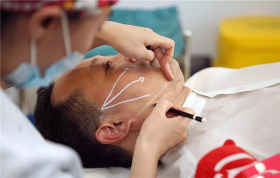 大v线和小v线的区别 你一定要收藏的线雕干货