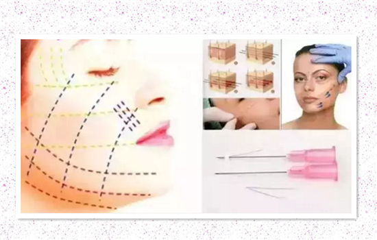 大v线和小v线的区别 你一定要收藏的线雕干货