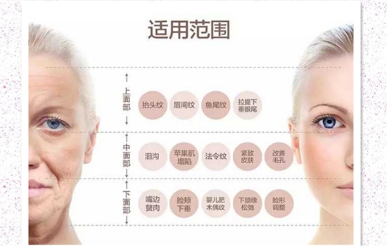 大v线提升适合什么年龄做 黄金年龄段在25-35岁