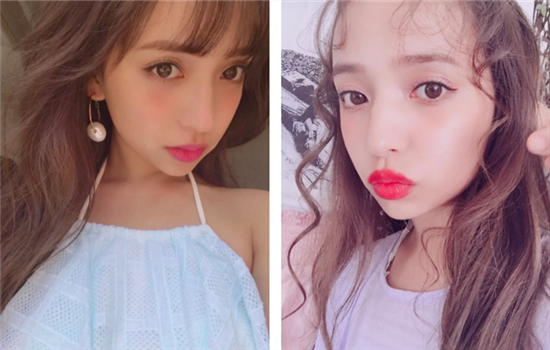 全切双眼皮几天拆线 拆线后一定要懂如何避免感染留疤