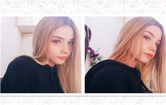 全切双眼皮宽窄不一样怎么办 割双眼皮不可不知的知识