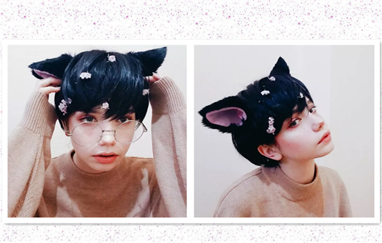 全切双眼皮宽窄不一样怎么办 割双眼皮不可不知的知识