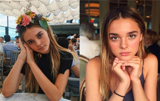 全切双眼皮为什么会掉 这三种原因导致双眼皮线消失