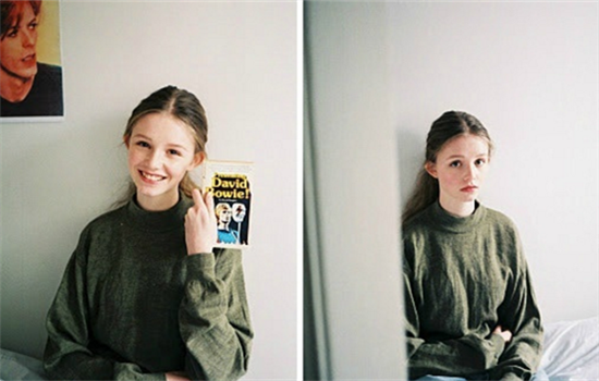 上睑提肌手术怎么做的 双眼皮提肌手术大揭秘