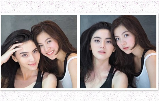 上睑提肌缩短术原理 提肌手术是怎样给你大眼睛的