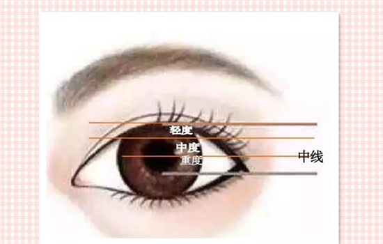 上睑下垂矫正原理 小仙女懂得更多才不会被忽悠