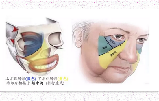 小v线和大v线哪个好看 根据自身条件出发来选择最好