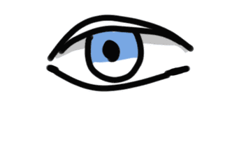 双眼皮手术恢复过程 割双眼皮,为什么你恢复的比别人慢?