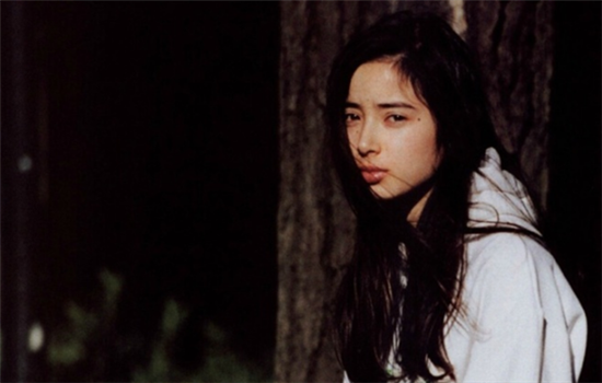 开外眼角怎么开 详解外眦开大术7部曲