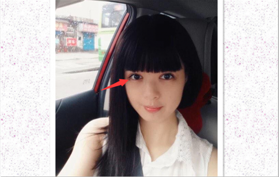 开外眼角后悔了 5位受术者告诉你为什么会后悔