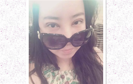 开内眼角七天拆线图片 内眦开大术初期恢复有图有真相