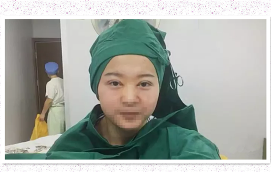 开内眼角手术过程 真人手术步骤图告诉你内眦开大步骤