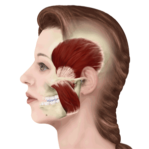 瘦脸针要一直打吗 只做到这一点瘦脸针就不用一直打下去