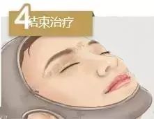 线雕是什么 线雕不是整容，是微调！！！