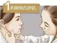 线雕是什么 线雕不是整容，是微调！！！