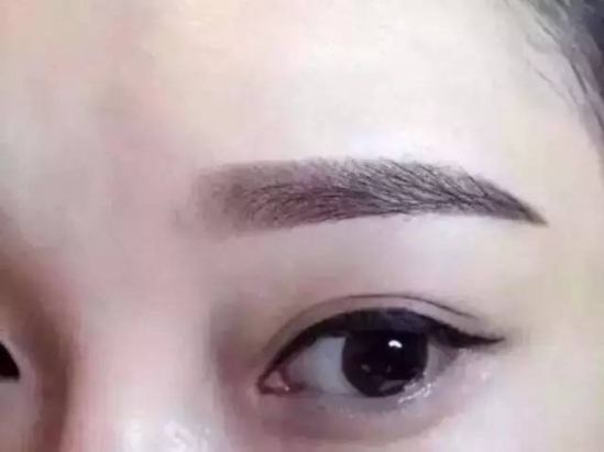 美瞳线的危害 美瞳线别瞎搞,低调点最好!