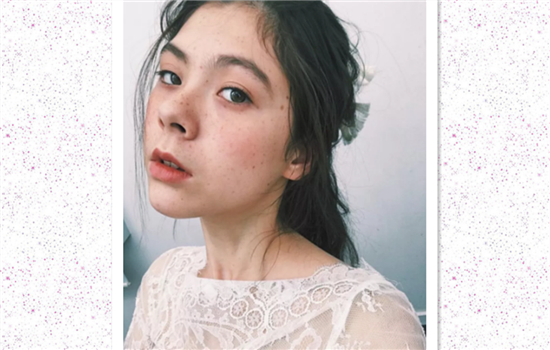 瘦脸针那个牌子的最好 正规瘦脸针优缺点大火拼